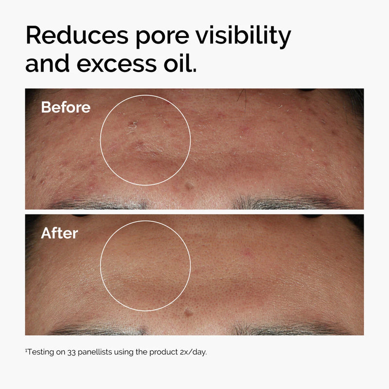 The Ordinary - Niacinamide 10% + Zinc 1% Serum