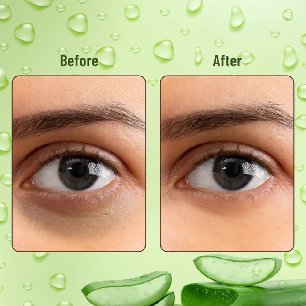 Swiss Beauty Hydra Eye Serum Patch Aloe Vera