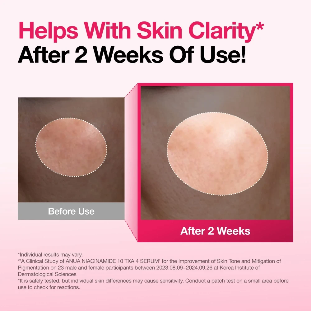 Anua Niacinamide 10% + TXA 4% Dark Spot Correcting Serum