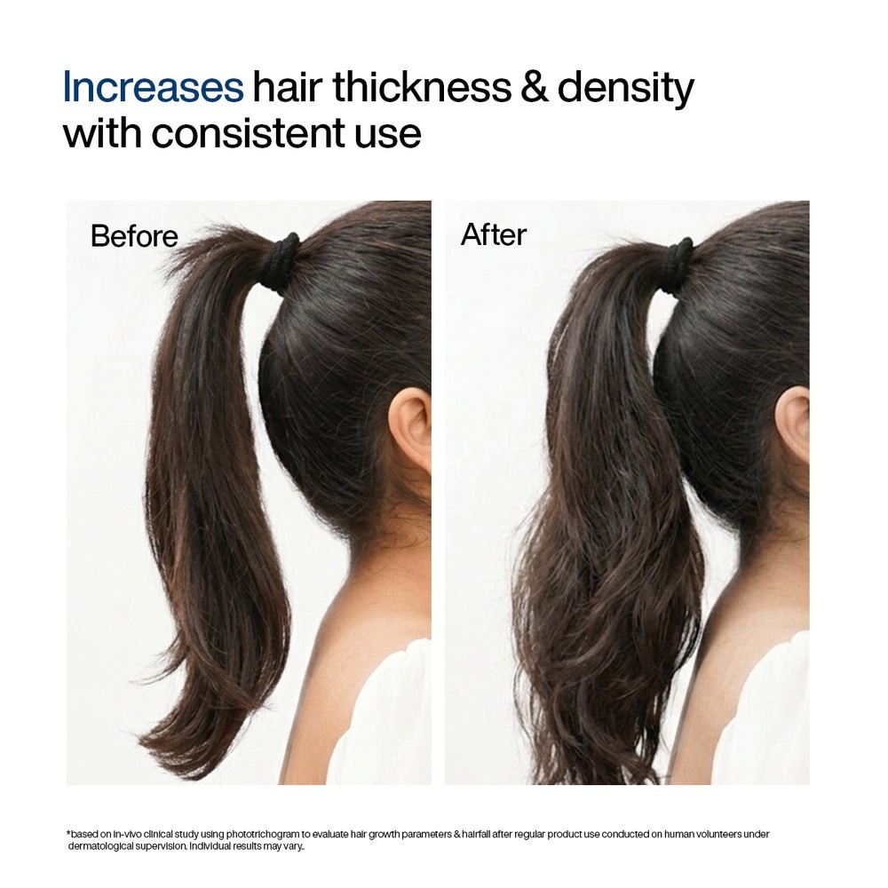WishCare Hair Growth Serum Concentrate