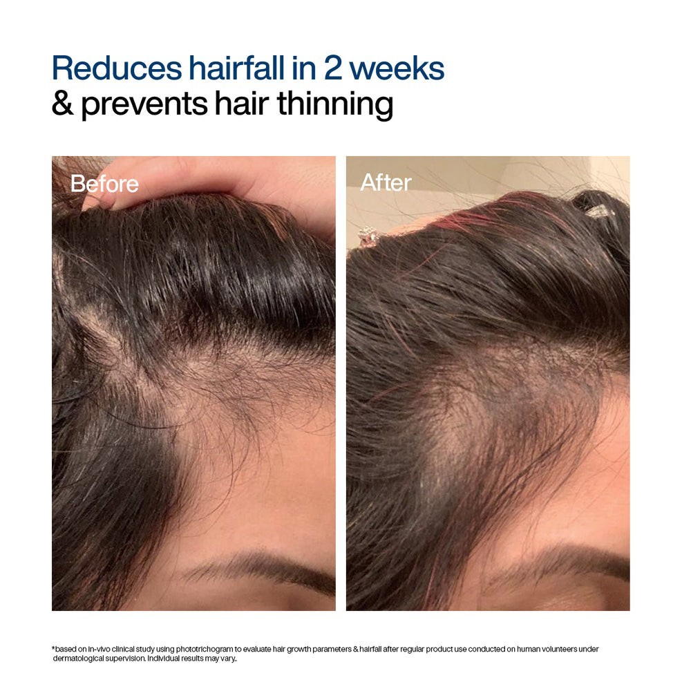 WishCare Hair Growth Serum Concentrate