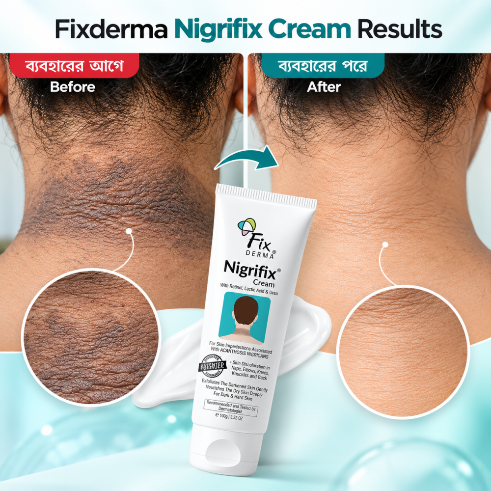 Fixderma Nigrifix Cream for Acanthosis Nigricans