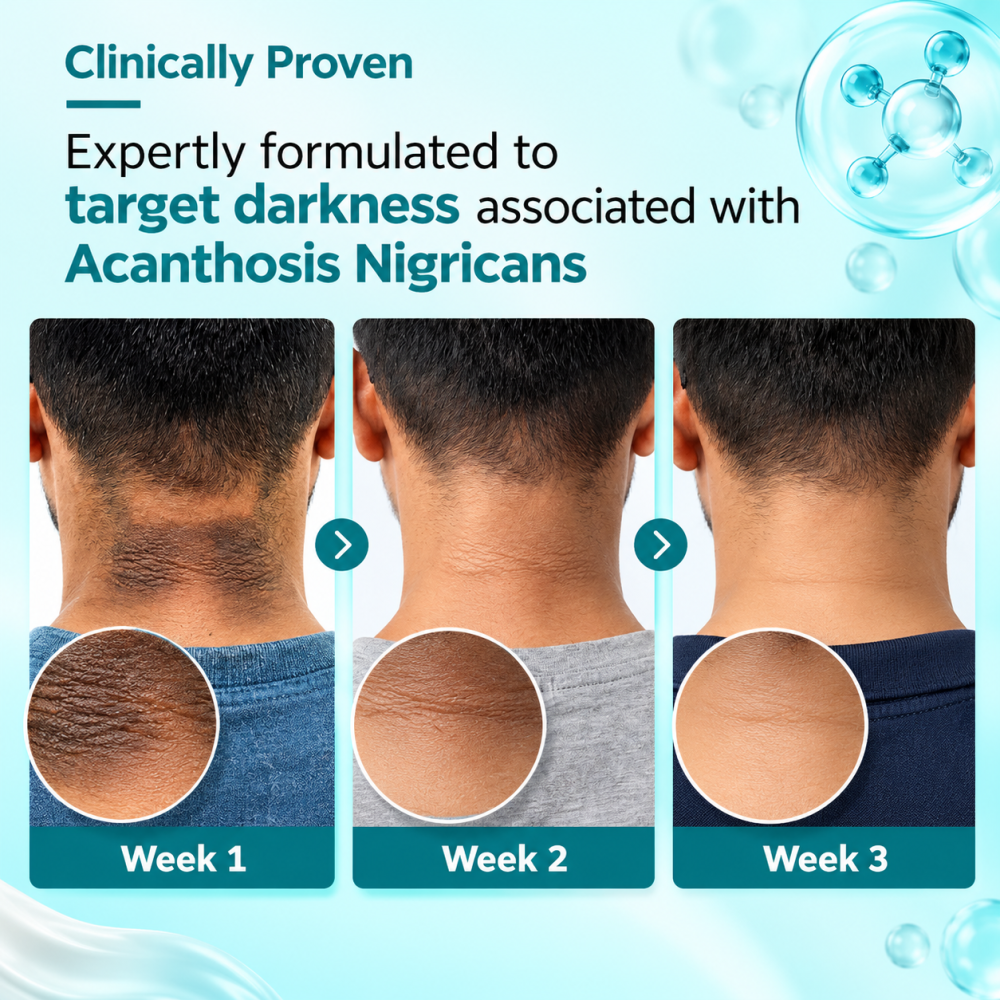 Fixderma Nigrifix Cream for Acanthosis Nigricans